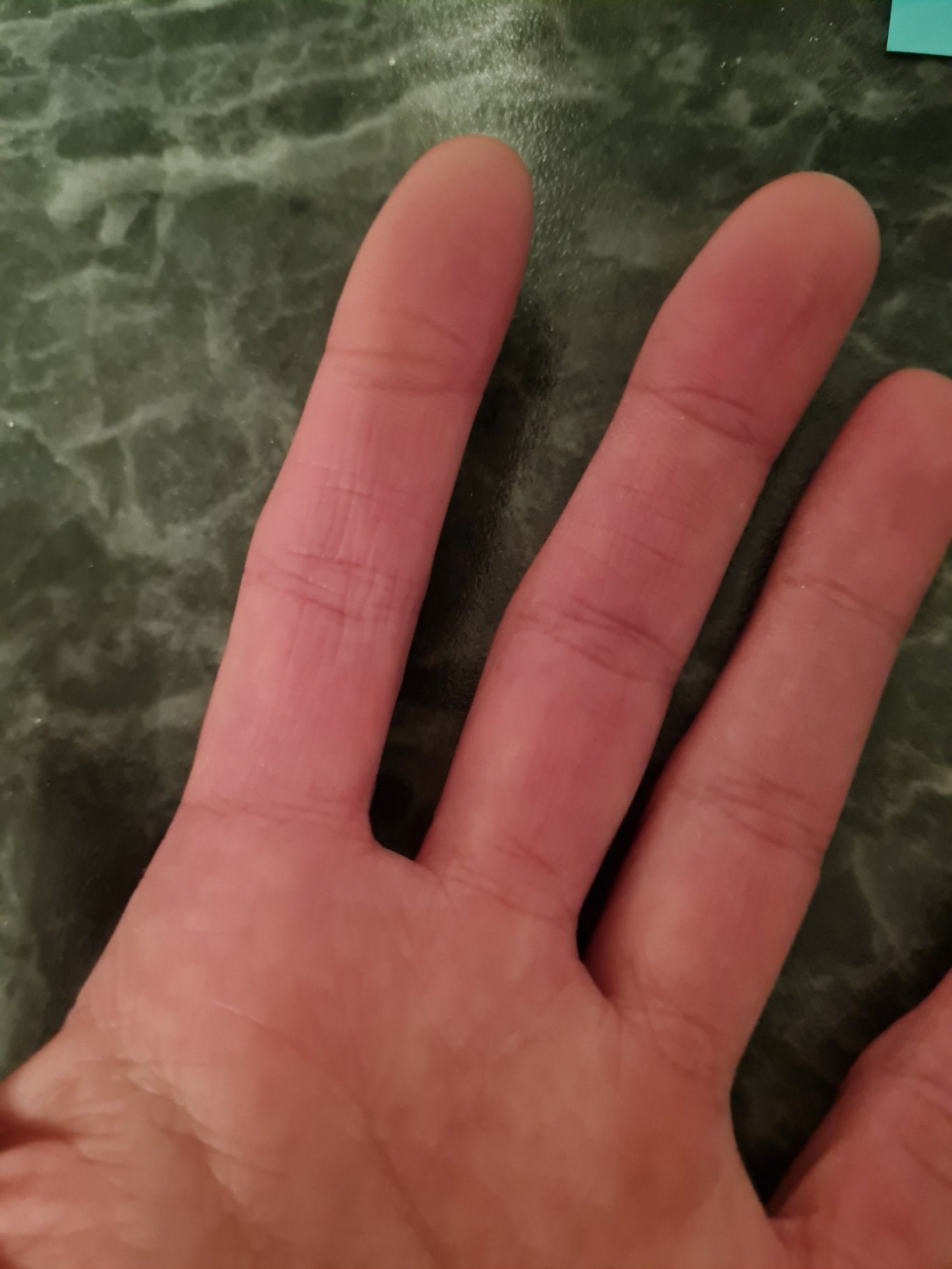 Hautzustand nachher Hautzustand nachher